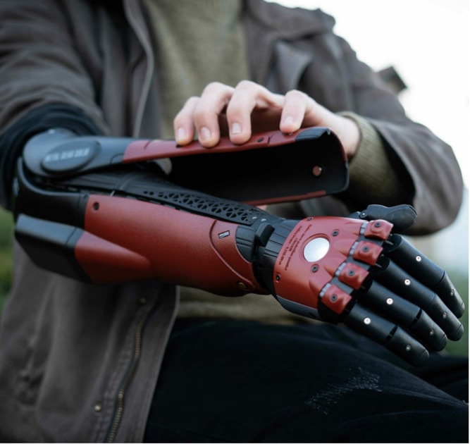 Reimbursement bionic arm prosthesis - Amputee Care Center