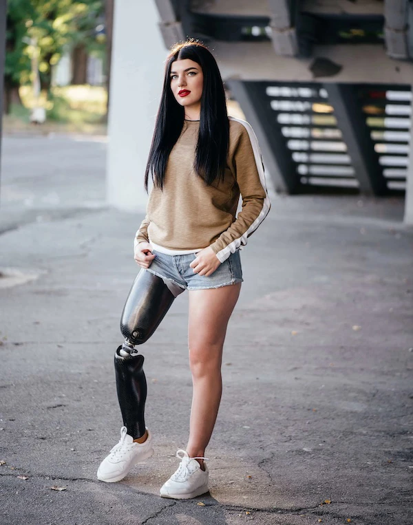 Transfer prostheses after upper leg amputation