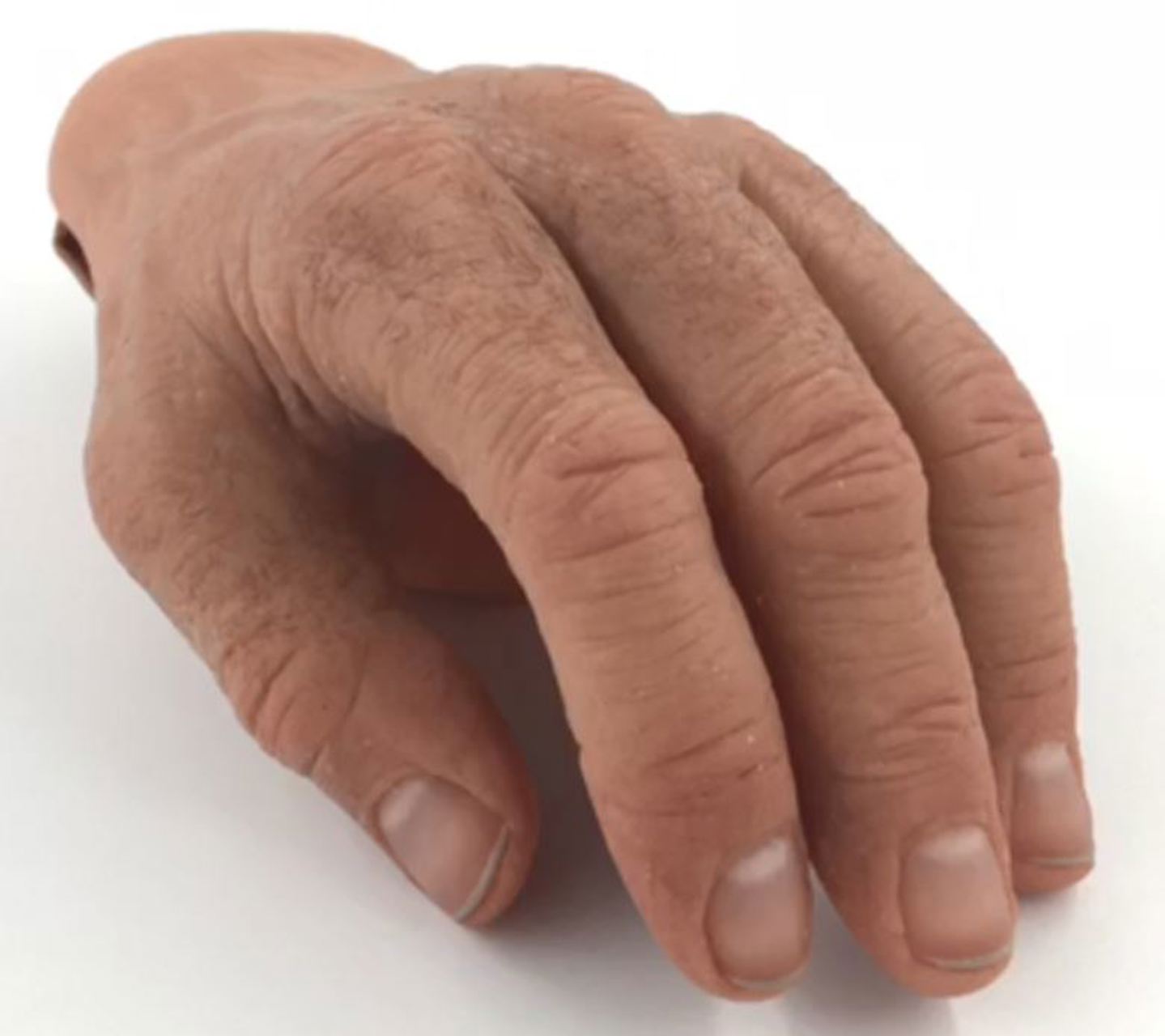 Silicone Hand Spronken orthopedie