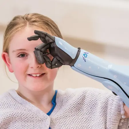 Armprothesen voor kinderen