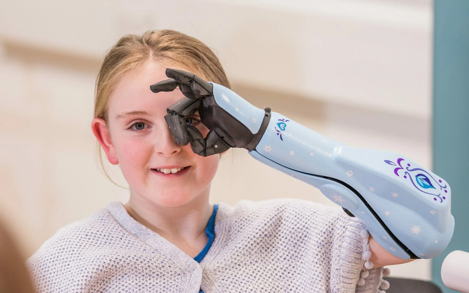 Meisje met Openbionics hero arm bij Amputee Care Center