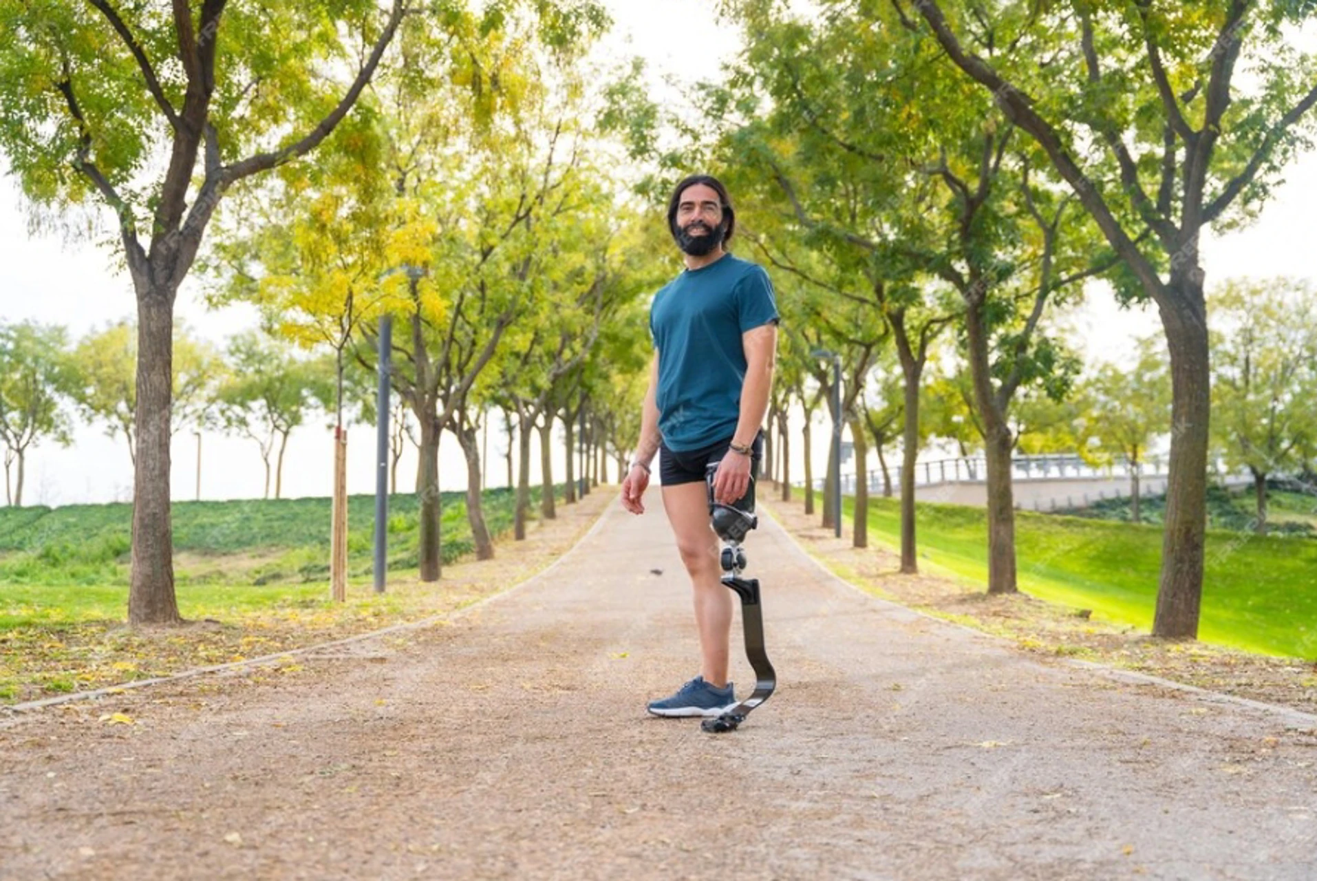 Ik heb of krijg een bovenbeenamputatie, wat nu?