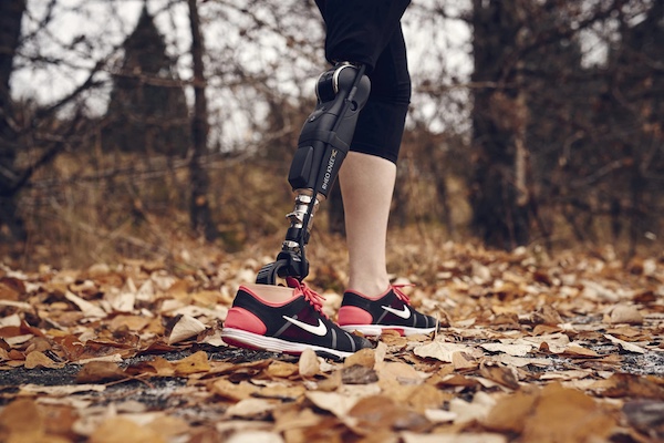 Discover the benefits of the new generation MCK electronic knee