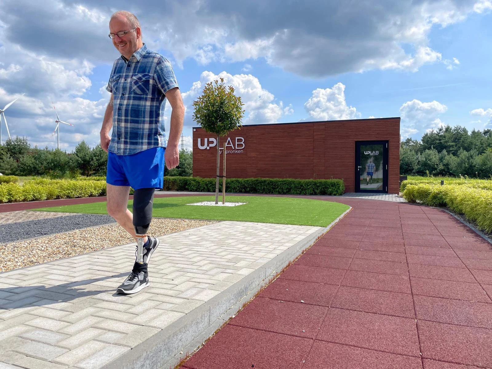 Echte tevreden patiënten na beenamputatie krijgen deskundige zorg in het amputatiezorgcentrum