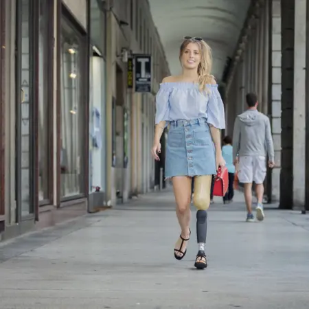 Amputatieniveaus beenamputatie