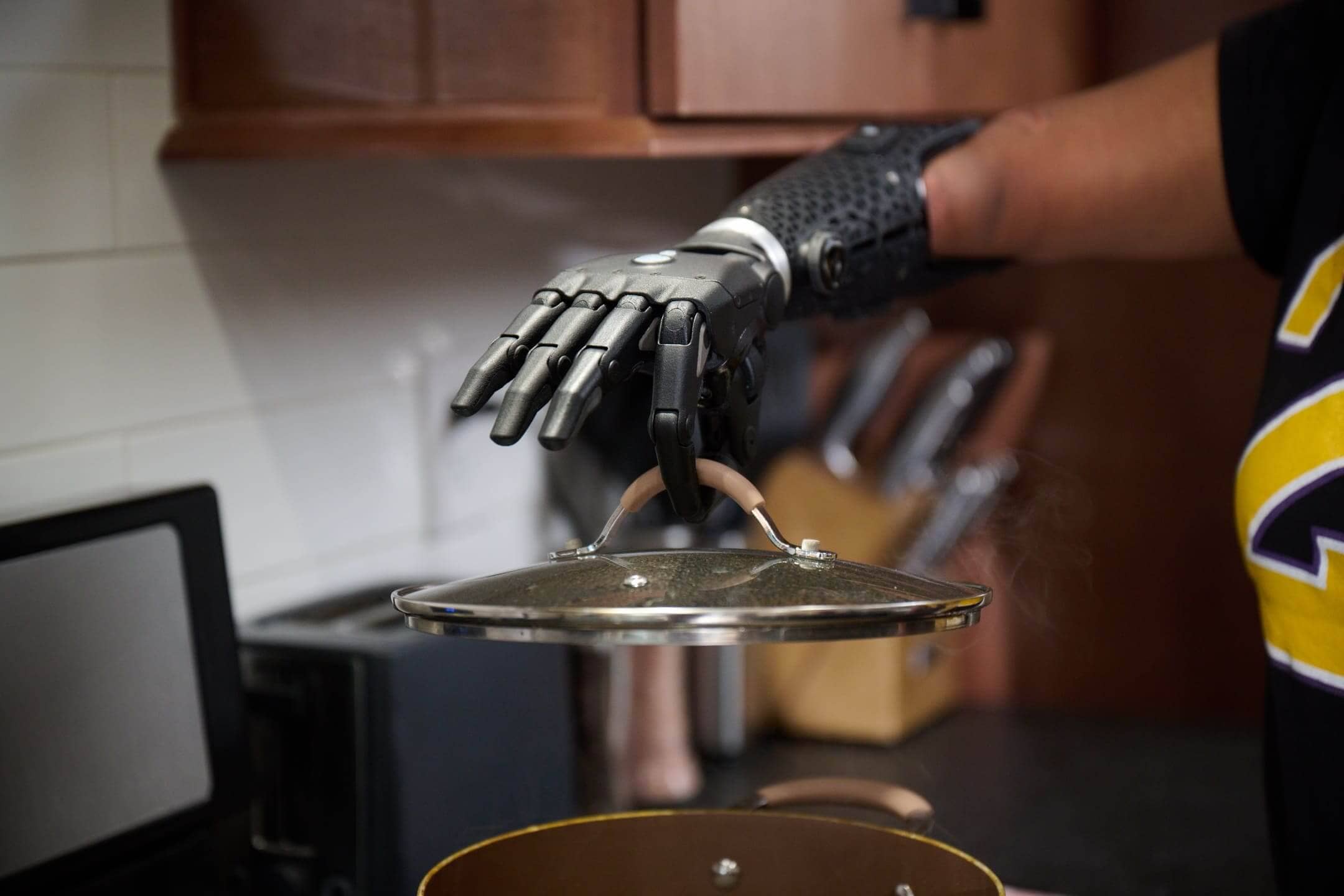 Open Bionics by Spronken