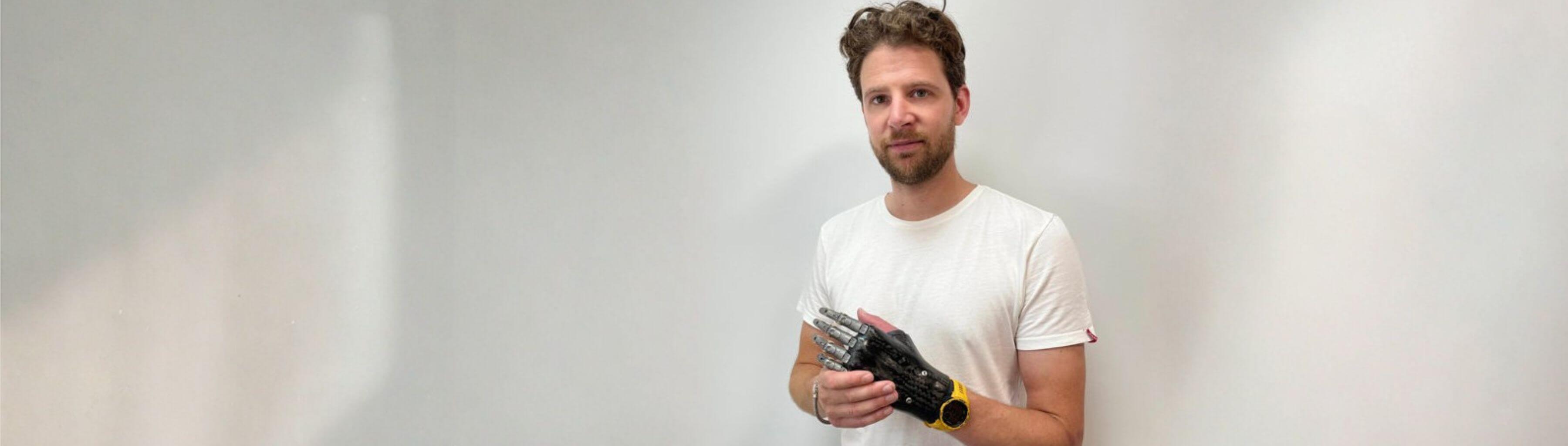 Tips for preventing skin problems when using prostheses