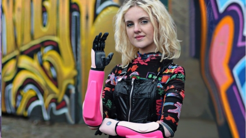 Myo-elektrische arm ideale opstap naar bionische prothese