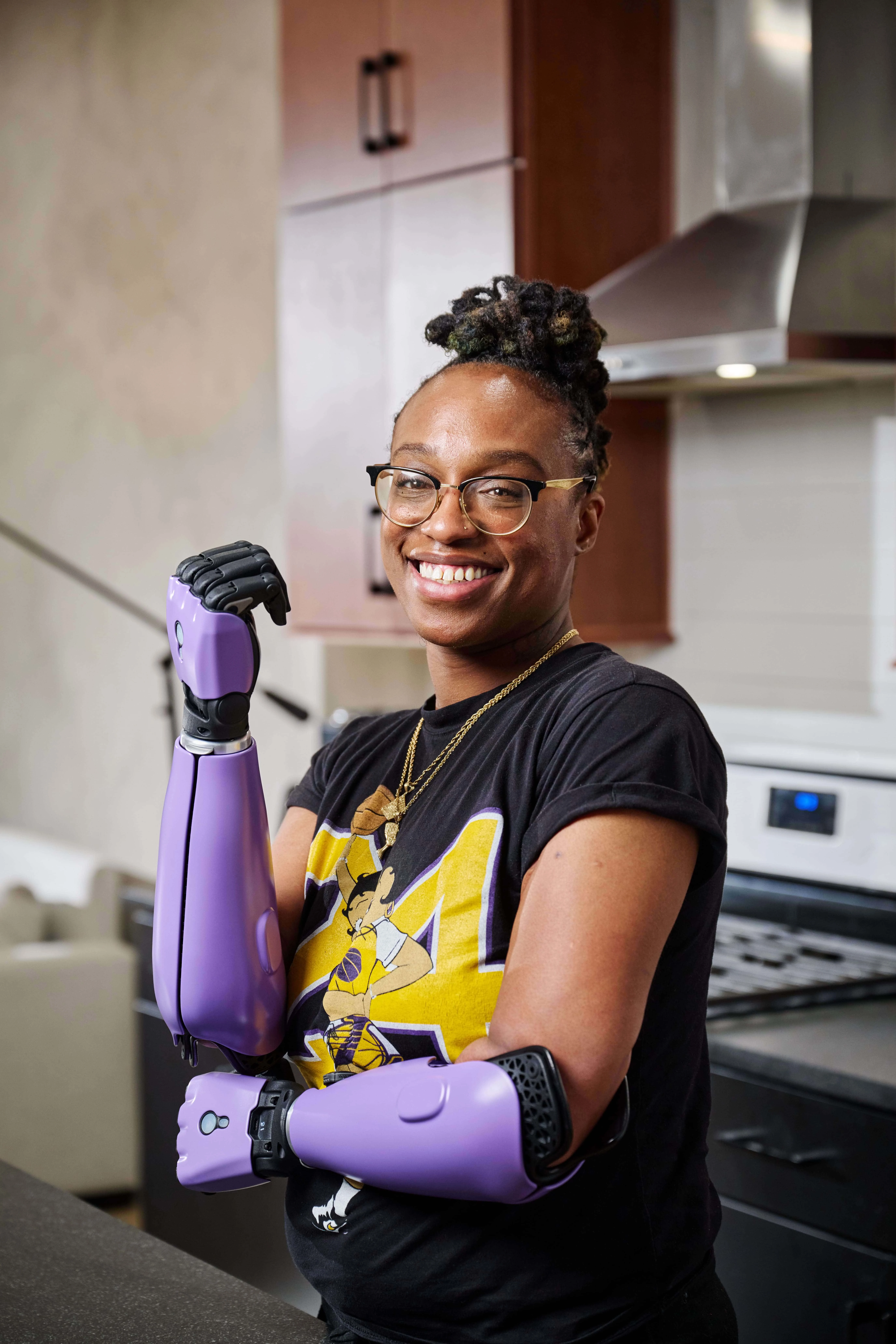 Open Bionics