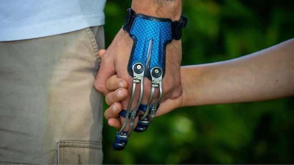  finger prostheses 