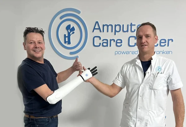 Man with a bionic prosthetic arm gives a high five to a prosthetist from the Amputee Care Centre