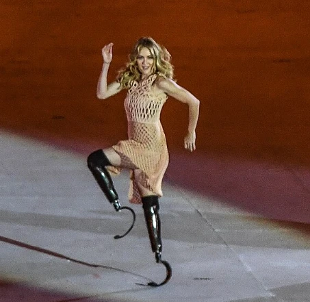 Dansen met je dagdagelijkse beenprothese