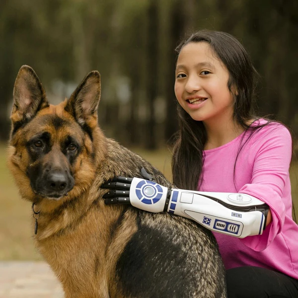 Une fillette caresse son chien avec son bras prothétique