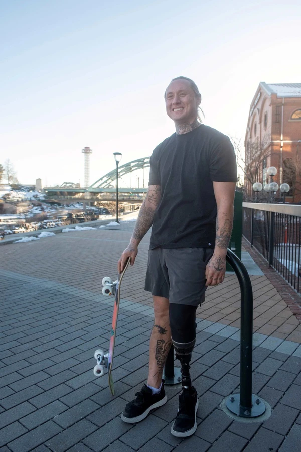osseointegration prosthetic ensuring a secure connection with the body