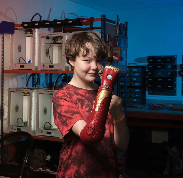 Hero Arm by Open Bionics lets children shine again