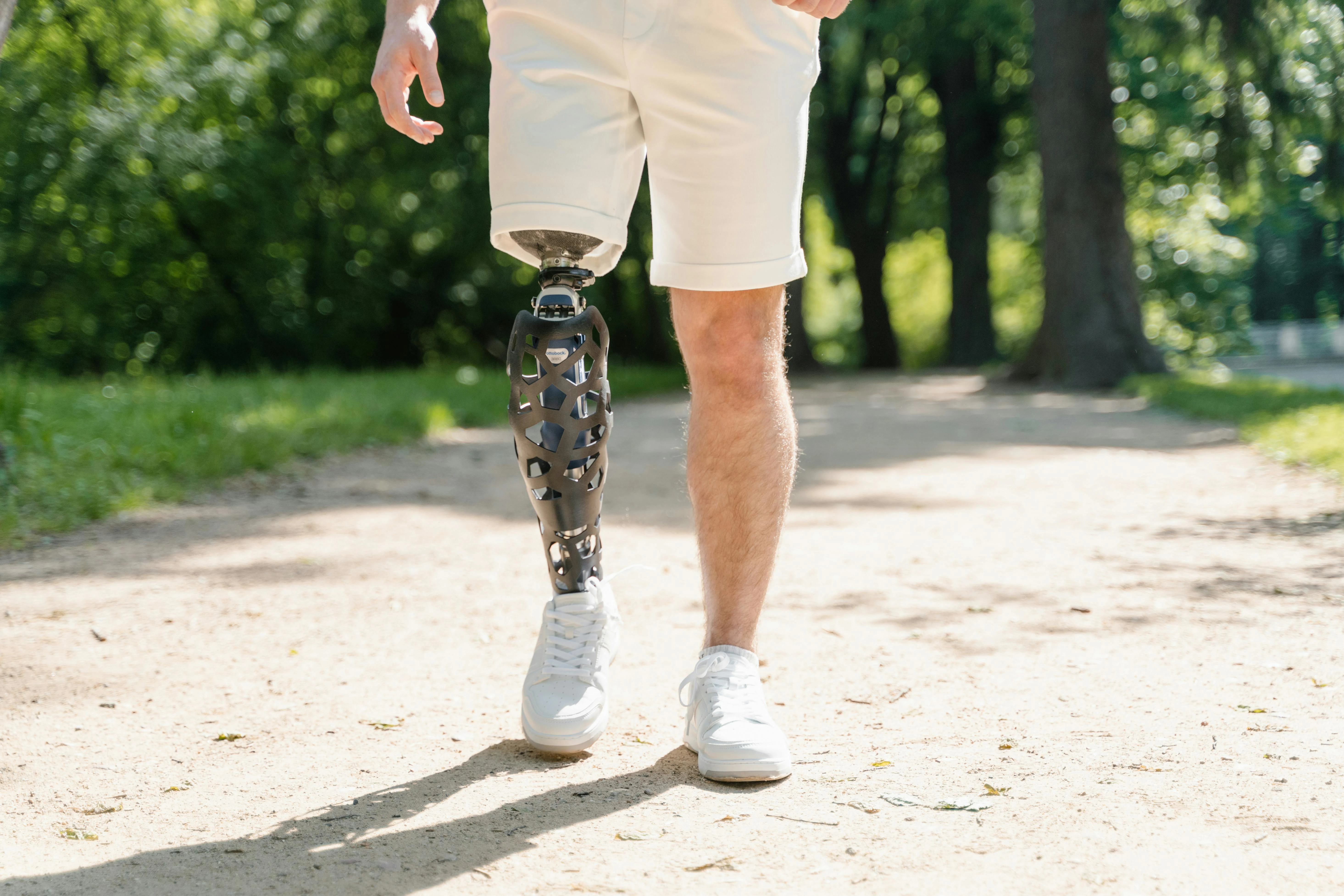 Man walking with a prosthetic leg