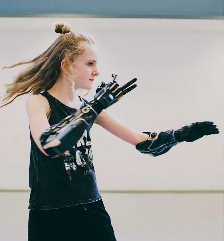 prothèses sportives pour les jeunes amputés de la main ou du bras