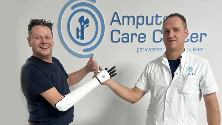 Benelux first : first 3D printed bionic arm delivered