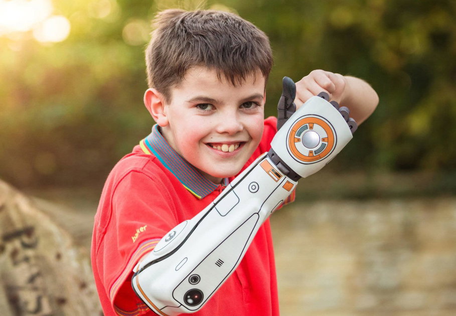 Open Bionics Hero Arm information - Amputee Care Center