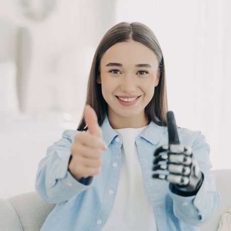 Bewerkt2happy Disabled Girl With Prosthetic Arm Showing Thumb Up Gesture Recommends Bionic Hand Prosthesis