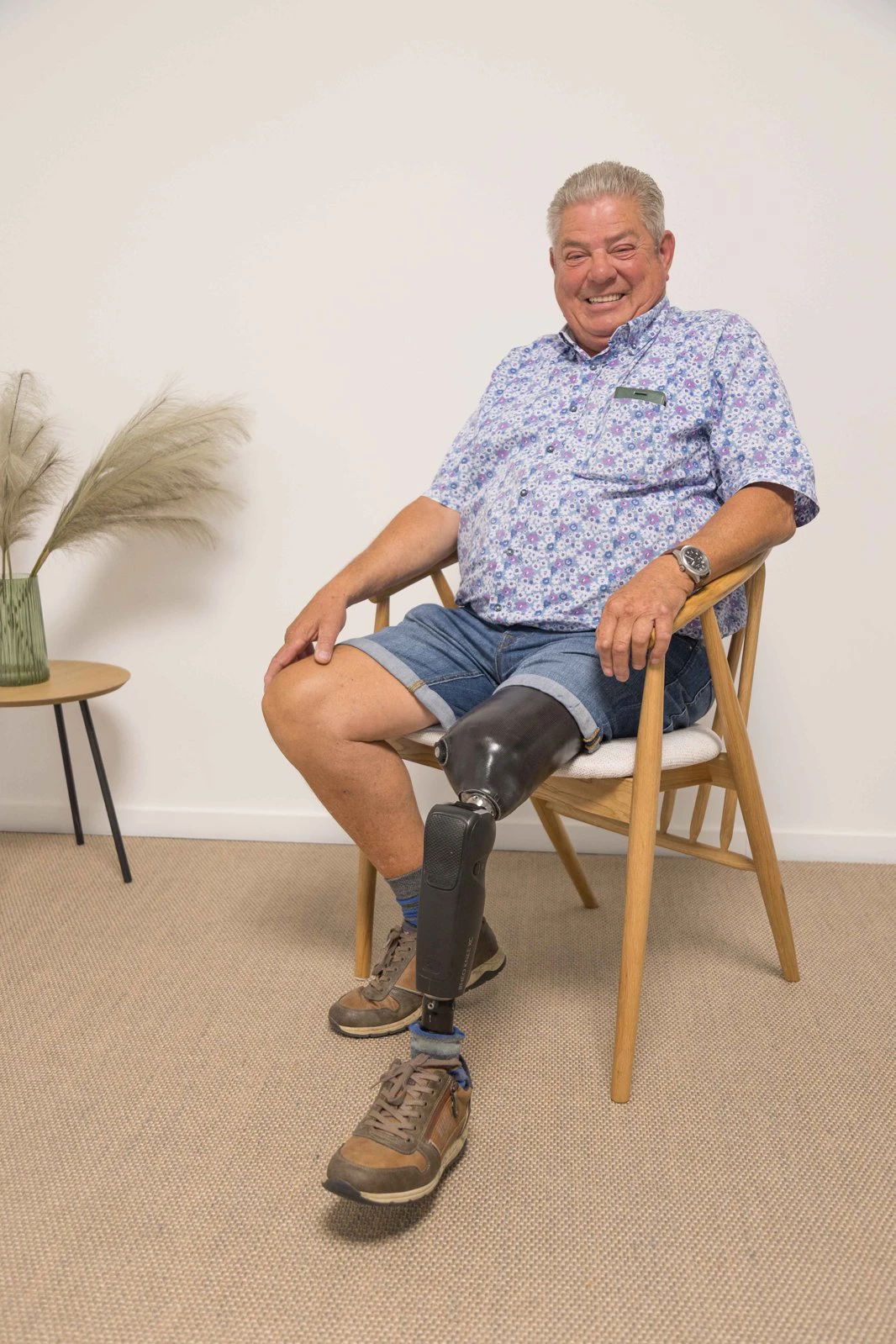 Amputation de la cuisse (amputation transfémorale)