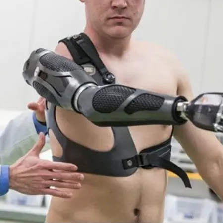 Prosthetic care