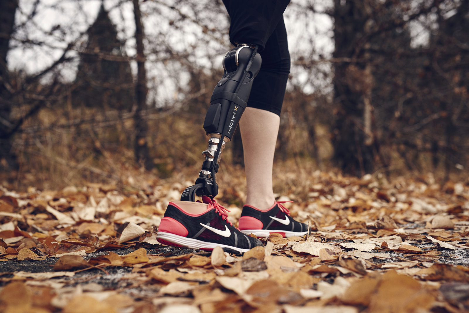 MCK vergoeding en aanvraagprocedure in Nederland