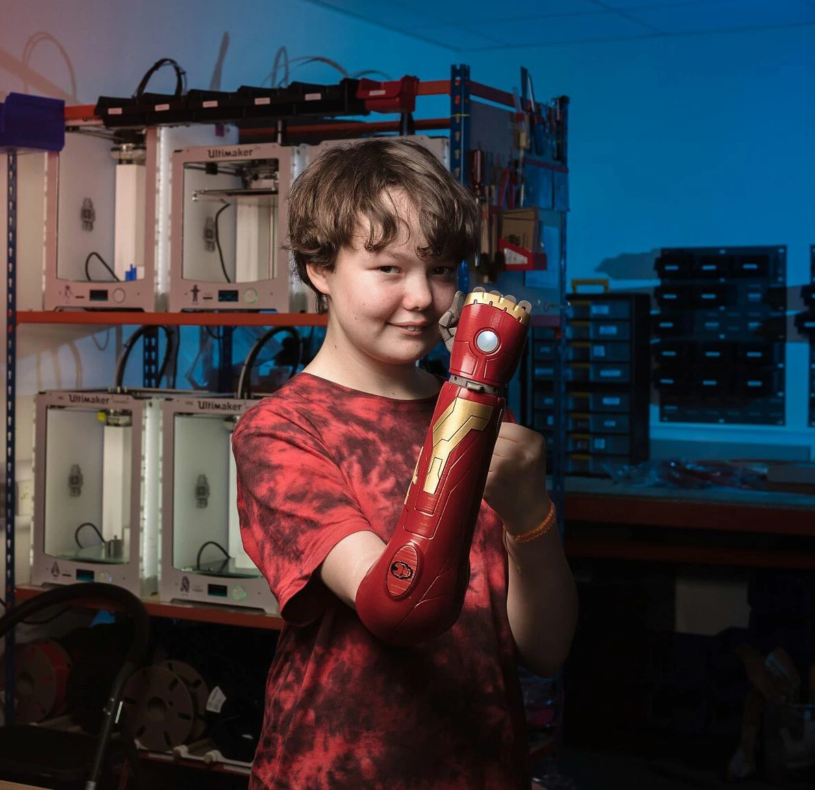 Amputation levels arm prostheses