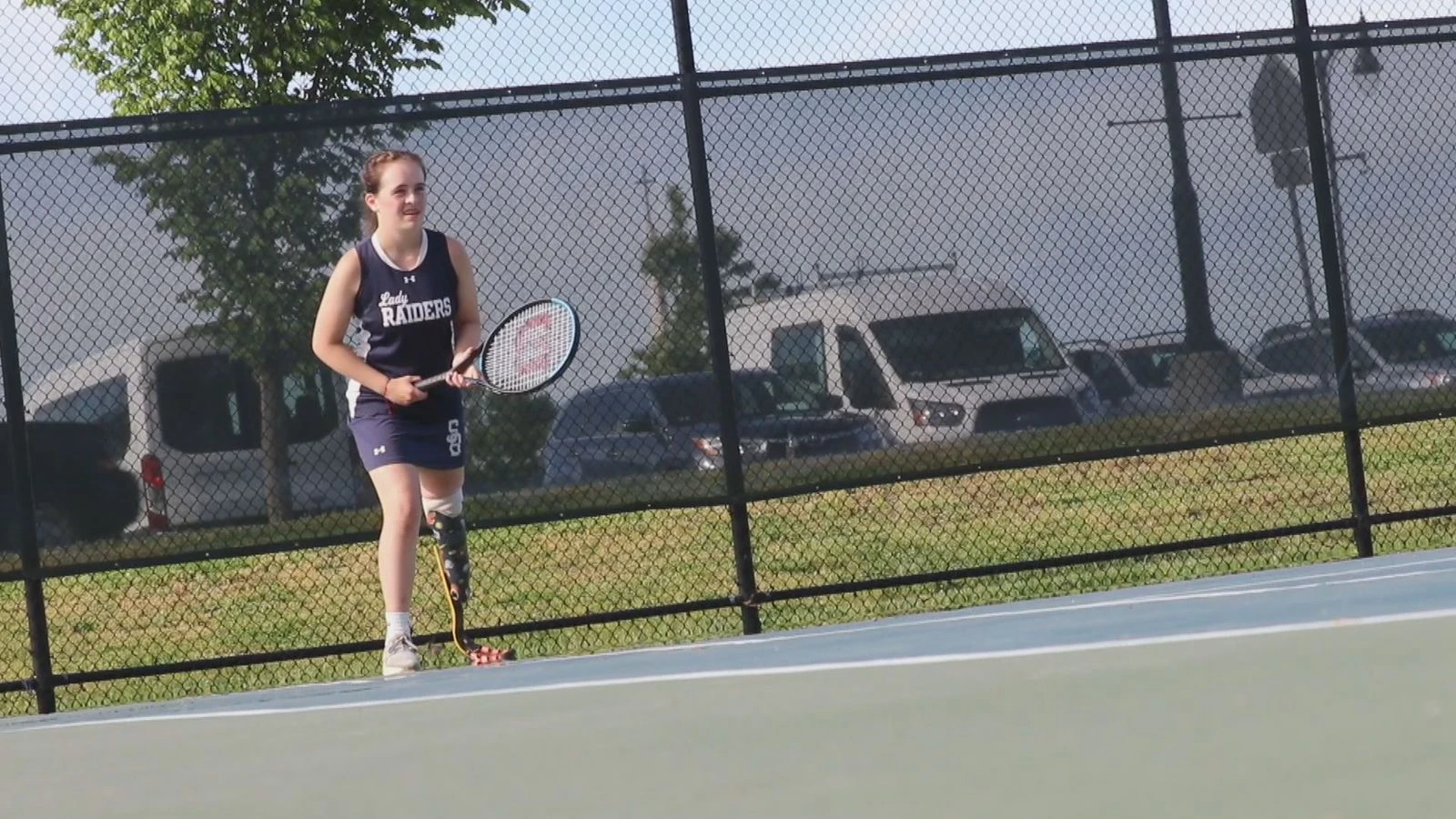 Ook kinderen en tieners kunnen bij ons terecht voor een gepaste protheseoplossing